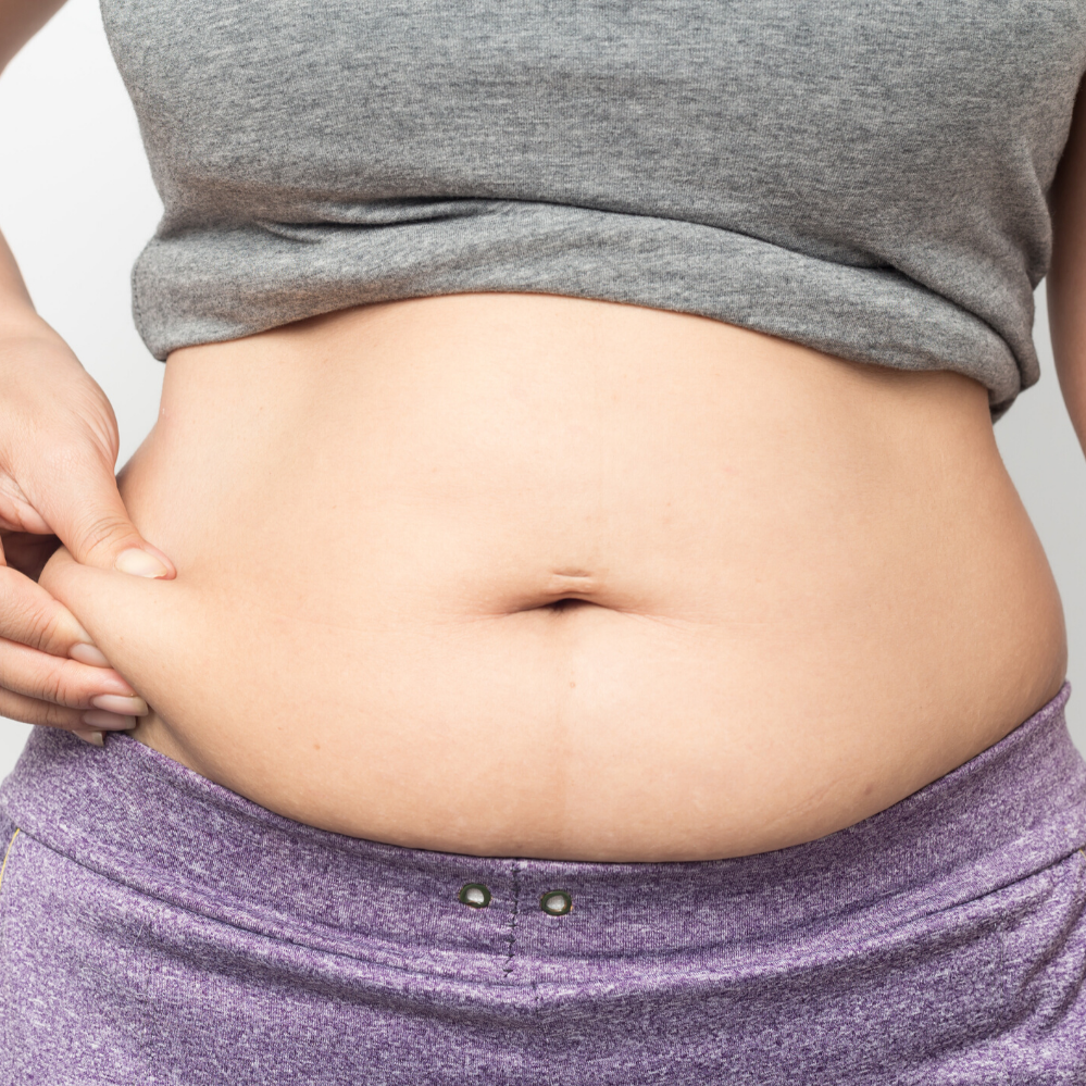 Tough to Remove Body Fat